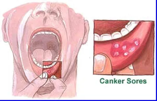 Vista 4 de Miracle Brite Smile - Enjuague bucal esencial de oxígeno para dientes más blancos, aliento más fresco y encías más saludables, menta, 12 onzas