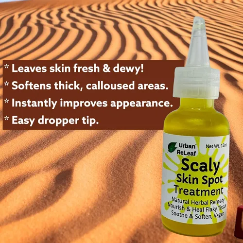 Vista 4 de Urban ReLeaf Tratamiento de manchas de piel escamosa. Aceite reparador suavizante de la piel, alivio natural para manchas escamosas, agrietadas
