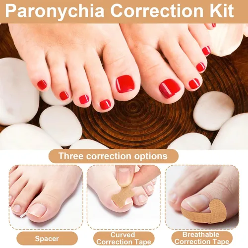 Vista 3 de Kit de 16 piezas de uñas encarnadas, con tiras transpirables para uñas de los pies en crecimiento, corrección de dedos curvos, parches de yeso sin