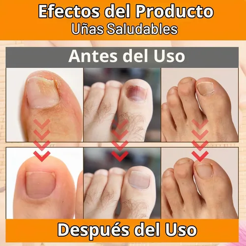 Vista 6 de 100 parches de uñas, tiras de aspecto de uñas de 8 horas durante la noche, extra adhesivas, calcomanías de lactancia diaria