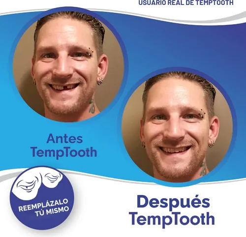 Vista 4 de El producto de sustitución dentaria temporal n.'º 1 en ventas, con herramientas dentales gratuitas, de Temptooth