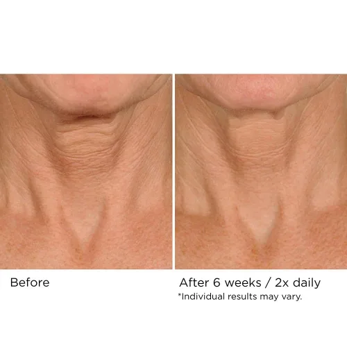 Vista 9 de NassifMD Deco-Lift Neck & Decollete Firming & Lifting Complex