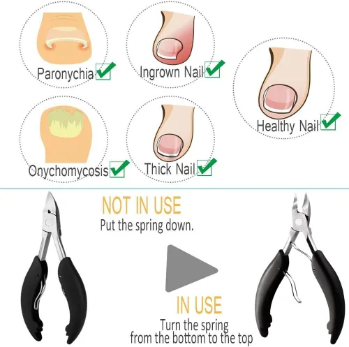 Vista 5 de Cortaúñas para dedos de los pies para uñas encarnadas o gruesas, recortador de uñas de los pies y podólogo profesional para personas mayores