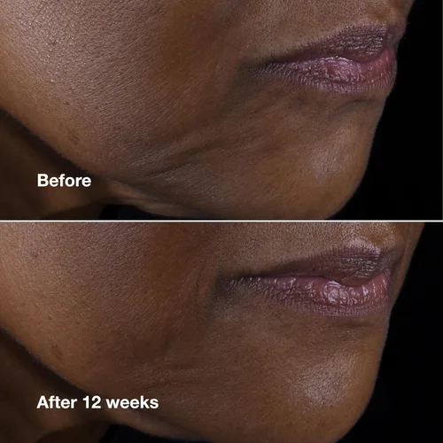 Vista 5 de Clinique Smart Clinical Repair Anti Aging Lifting Face + Neck Cream with Peptides + Hyaluronic Acid For All Skin Types Hydrating