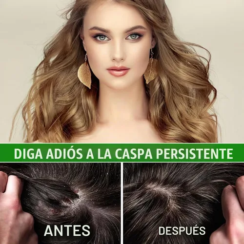 Vista 5 de KMSH Aceite de batana 100% puro para cabello, 2 onzas, aceite de masaje natural para cabello seco, dañado y encrespado, aceite de cabello