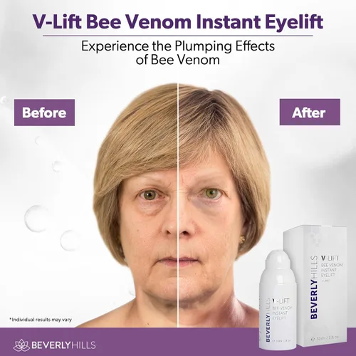 Vista 2 de Beverly Hills V-Lift - Suero de veneno de abeja para ojos hinchados, ojeras, arrugas y bolsas debajo de los ojos para mujeres y hombres, 1.0 fl oz