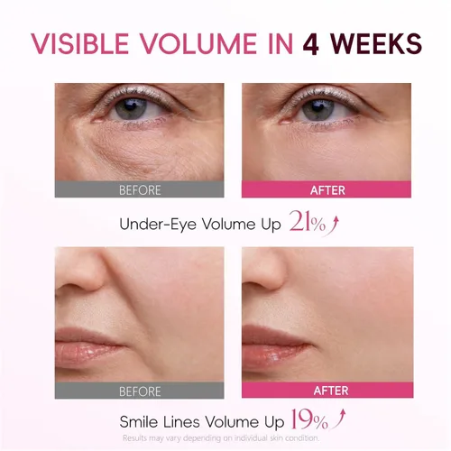 Vista 2 de APBM Volufiline Suero rellenador para la cara 5% de volufilina + 3% niacinamida + 1% multipéptido Volumen visible para líneas debajo de los ojos