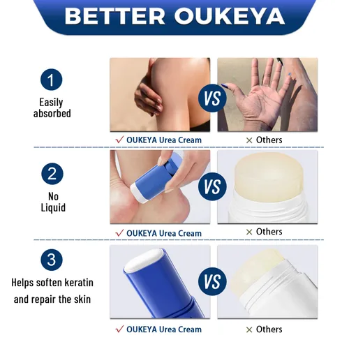 Vista 6 de OUKEYA Crema de urea 40 por ciento. Barra de crema de urea para pies y manos para talón agrietado seco, agrietado, evitar la congelación, loción