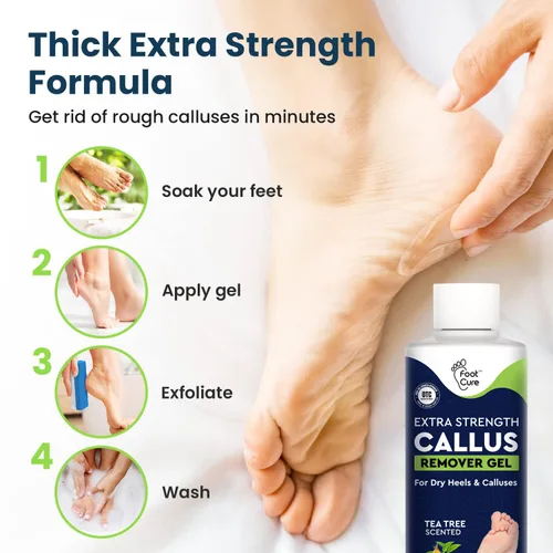 Vista 2 de Removedor de callos para pies con gel extra fuerte y juego de piedra pómez para pies, manera fácil de eliminar callos duros y la acumulación de piel