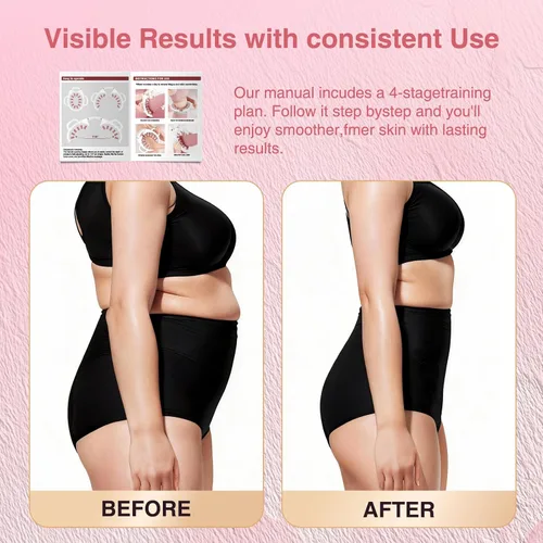 Vista 5 de Rodillo masajeador de drenaje linfático – Herramienta de fascia para piernas, muslos y pantorrillas – Escultura corporal de tejido profundo