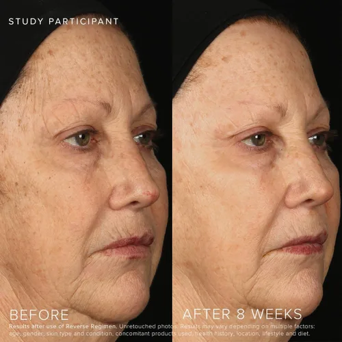Vista 5 de Rodan + Fields Régimen inverso: limpiador, tónico, loción SPF 50 y tratamiento Hidratante diario Contiene vitamina C y retinol Juegos y kits
