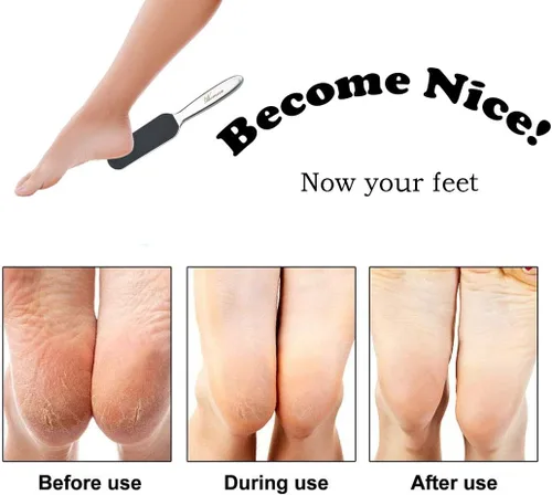 Vista 7 de Lima de pedicura profesional para pies – Reutilizable de acero inoxidable agrietado callos de la piel removedor de callos
