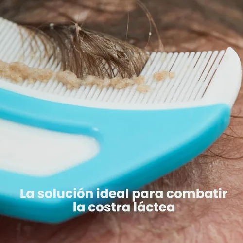 Vista 2 de Frida Baby El Sistema de Costra Láctea de 3 Pasos, DermaFrida The FlakeFixer, Esponja, Cepillo, Peine y Soporte de Almacenamiento para Bebés