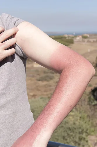 Vista 5 de Sombrero de pesca con protección solar, funda extraíble con solapa para el cuello con mangas para brazos para exteriores