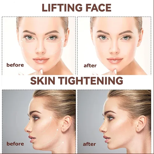 Vista 6 de Cinta de estiramiento facial invisible, 132 unidades, para doble barbilla, arrugas, levantamiento de piel flácida, cinta de levantamiento facial