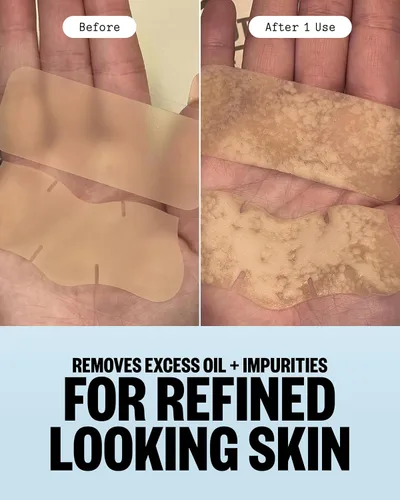Vista 7 de PEACE OUT Tiras de poros para nariz y cara, removedor de puntos negros hidrocoloide absorbente de aceite, tiras minimizadoras de poros con retinol