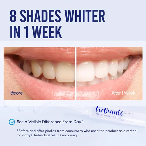 Vista 2 de VieBeauti Kit de blanqueamiento dental con luz LED para dientes sensibles, 35% de peróxido de carbamida, gel remineralizante para resultados