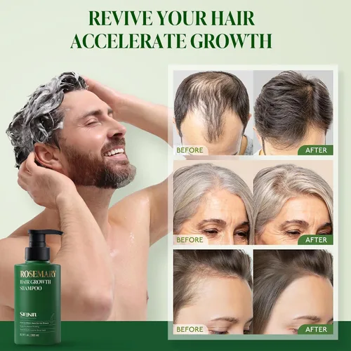 Vista 3 de Champú de biotina de romero para adelgazar el cabello, crecimiento