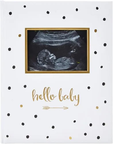 Vista 8 de Pearhead Hello Baby - Álbum de fotos para bebé, libro de recuerdos para nuevos y futuros padres, accesorio para bebé de género neutro, regalo ideal