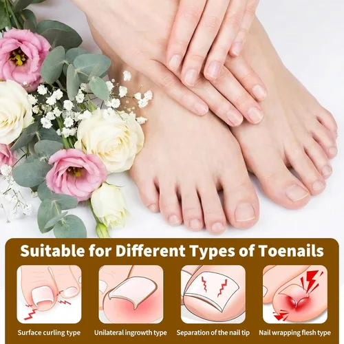 Vista 4 de Juego de corrector de uñas encarnadas con tiras correctoras y lima sin dolor, kit profesional de eliminación de uñas encarnadas con herramienta