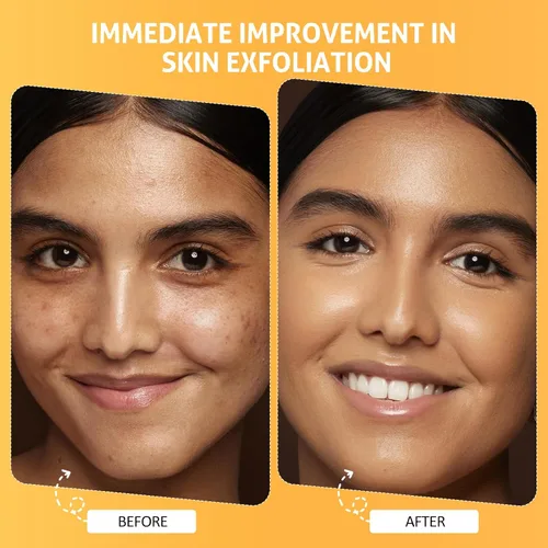 Vista 4 de RIHAKO Regalos de Pascua para mujeres, máscara facial con enzimas de calabaza, cuidado de la piel, mascarilla facial exfoliante iluminadora