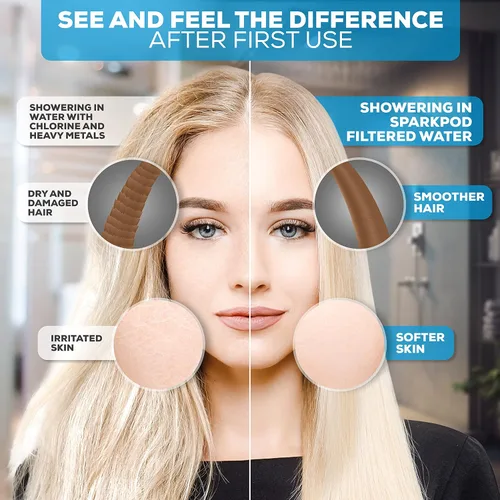 Vista 3 de SparkPod Cabezal de ducha filtrado con 8 ajustes de pulverización, filtro de agua adecuado para personas con cabello, piel y cuero cabelludo secos