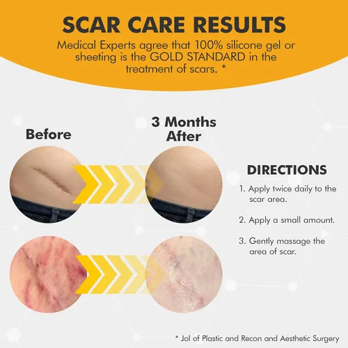 Vista 3 de DermAvance Pure Cicatriz Care "Gel de silicona de grado médico" para marcas quirúrgicas y faciales - Crema de silicona para un manejo eficaz