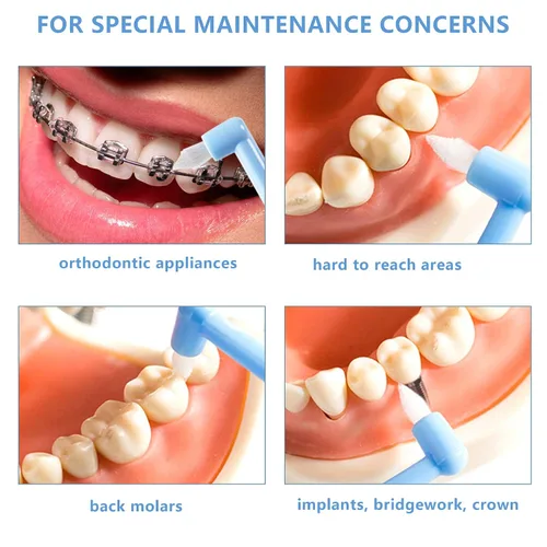 Vista 4 de LOVEWEE End-Tuft - Cepillo de dientes cónico, 6 piezas de cepillo interespacial copetudo, cepillo de dientes Wisdom Gap para ortodoncia, ortodoncia