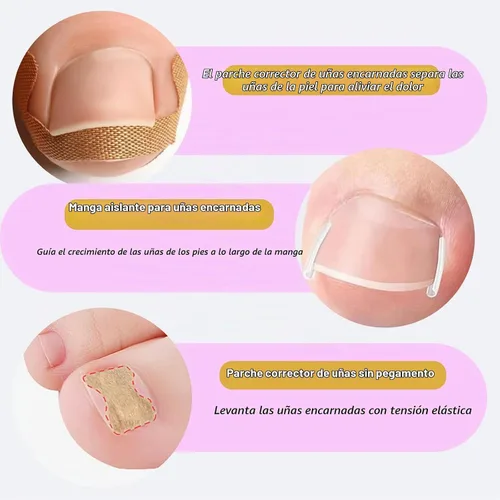 Vista 6 de Kit corrector de uñas encarnadas – tiras, parche, lima y levantador Breathable Ingrown Toenail Strips and curved toenail patch for home pedicure