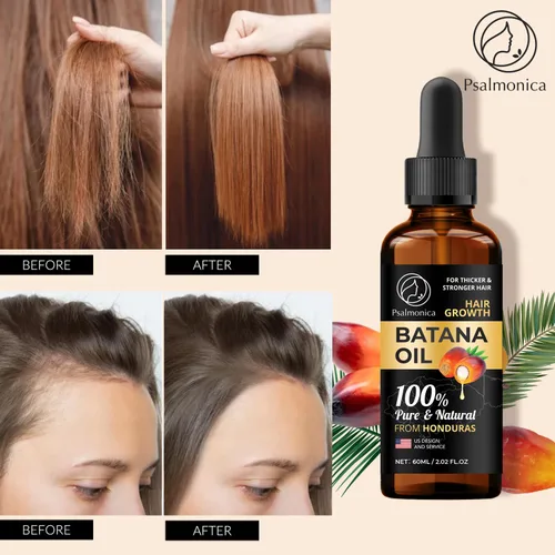 Vista 2 de Suero de crecimiento del cabello con aceite de batana 100% puro: suero natural para cabello más grueso y fuerte, aceite eficaz para el crecimiento