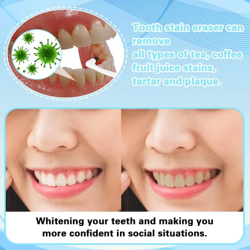 Vista 7 de Gjinxi Borrador de manchas de dientes, eliminadores de manchas dentales, raspador de dientes, rascador de placa dental, borradores de sarro, pulidor