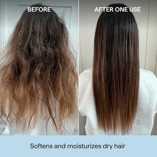 Vista 3 de Briogeo Scalp Revival Rosemary Pre-Wash Oil Moisturizing Scalp Treatment for Dry, Flaky, or Itchy Scalp Strengthens Hair & Soothes Scalp Vegan