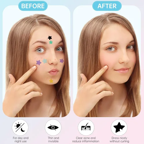 Vista 4 de Parche para espinillas para acné, hidrocoloide absorbente, lindas cubiertas de estrellas para espinillas de estrellas para rostro, parches