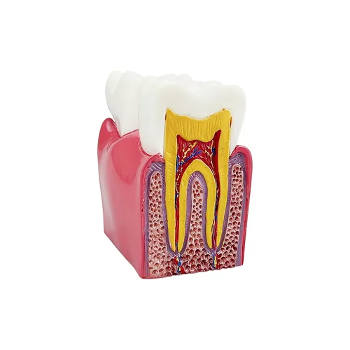 Vista 8 de Modelo de dientes de caries dental, modelo YOUYA DENTAL 6 veces de dientes de caries modelo de anatomía dental para educación de dientes