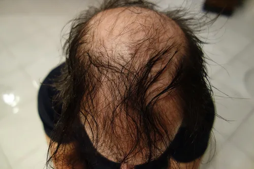 Vista 3 de Fibras de relleno de cabello, recarga de 1.76 onzas más 4.1 onzas Pulverizador fijador de fibra resistente, recarga para tu frasco actual Fibra