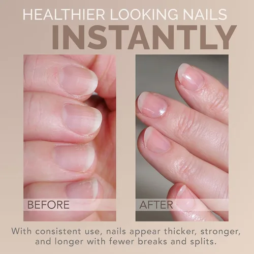 Vista 6 de Perfect Formula Capa de gel transparente, fortalecedor de uñas, tratamiento de queratina, esmalte de uñas transparente, fortalecedor para uñas