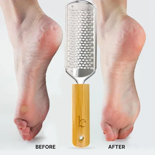 Vista 2 de Lima de pies – Herramienta para eliminar callos para la piel muerta, herramientas de pedicura en casa, raspador de pies y talones, pies suaves