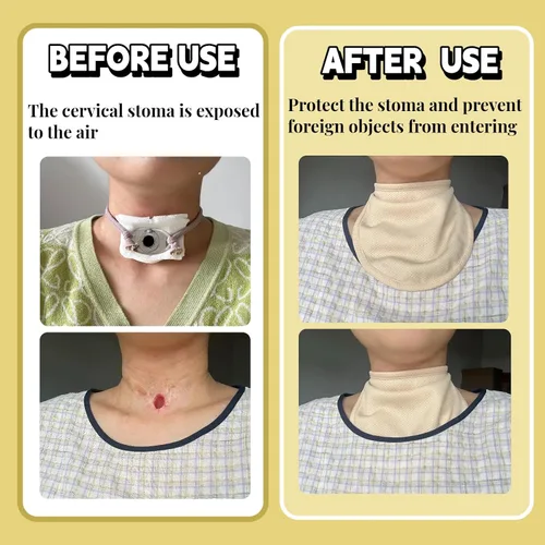 Vista 4 de Funda de traqueotomía para adultos, protector de estoma de cuello transpirable, protector de estoma de traqueotomía de algodón suave para polvo