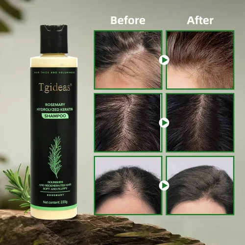 Vista 3 de Tgideas Champú de romero y biotina - Voluminizador, sin sulfato, para cabello fino, seco y dañado, vegano, seguro para el color, 14.8 fl oz