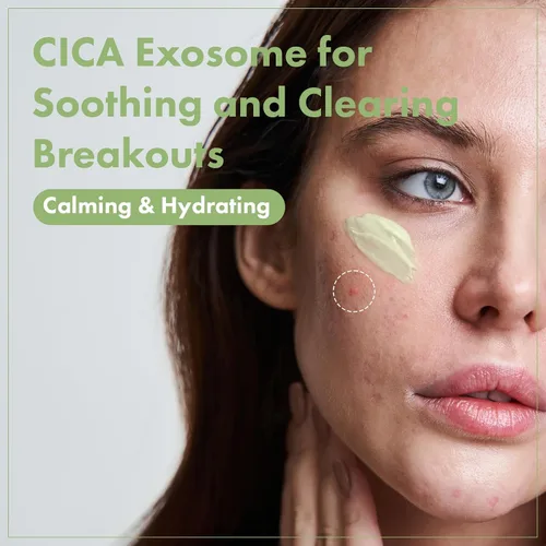 Vista 2 de TOSOWOONG Exosome CICA Crema Facial - Hidratante diario calmante para brotes y piel irritada, acción rápida, ligera para el cuidado de la piel