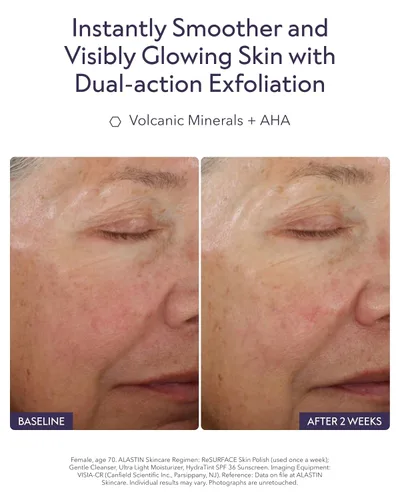 Vista 3 de ALASTIN Skincare ReSURFACE - Esmalte exfoliante para la piel (2.3 onzas) Exfoliante facial para una piel más suave y tersa Con ácido glicólico