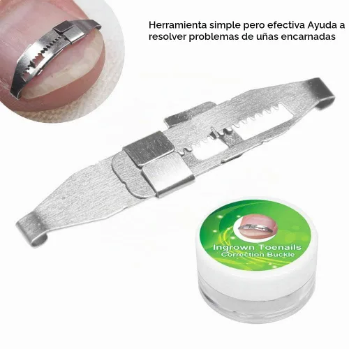 Vista 5 de Corrección de uñas encarnadas plateadas de 17 a 0.866 in ajustable de acero inoxidable corrector de uñas de pedicura paroniquia herramienta
