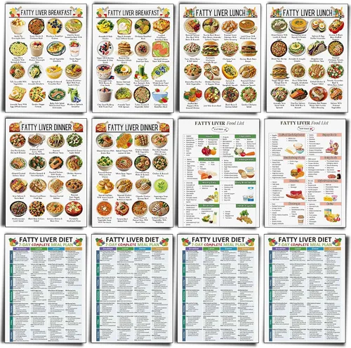 Vista 21 de Sinload 12 piezas de póster de dieta de alimentos para reflujo ácido, lista de dieta para ERGE, alimentos bajos en ácido, lista de compras