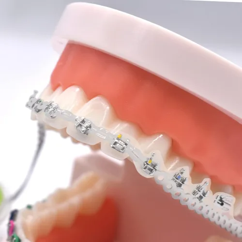 Vista 3 de RZJZGZ Cadenas elásticas dentales transparentes de ortodoncia para cadenas de poder, carrete de ortodoncia, banda de goma elástica (cerrada)