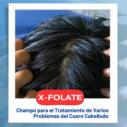 Vista 5 de Mediceuticals X-Folate Shampoo Champú Anticaspa para Mujeres y Hombres – Control Persistente de la Caspa – Para la acumulación de cuero cabelludo
