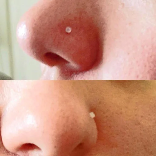 Vista 2 de Anillo de nariz transparente Bioflex, aretes de nariz en forma de L, sacacorchos para la nariz, piercing para el cuerpo, conjunto de joyas