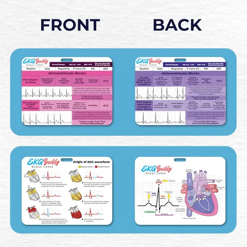 Vista 3 de Set de 5 tarjetas de interpretación de ECG de EKG Buddy - Tarjetas de ECG para enfermeras doble cara, guía de ritmo, hoja de trampa de ECG, tiras
