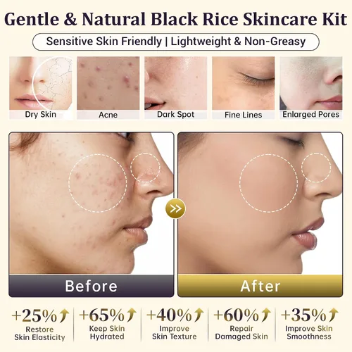 Vista 4 de Juego de rutina de cuidado de la piel de arroz negro natural para mujeres, kit antienvejecimiento con lavado facial, tóner, suero, loción corporal