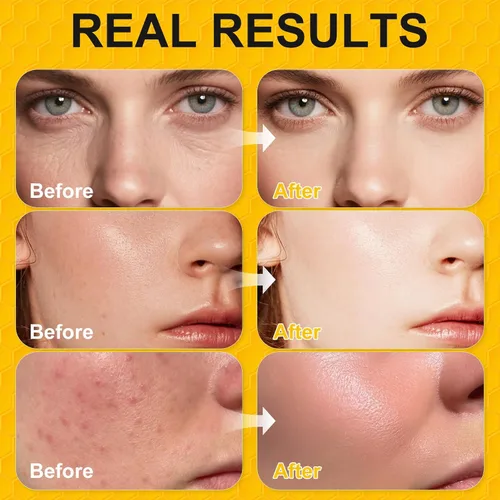 Vista 5 de Sarga de carne orgánica alimentada con pasto para piel, cuerpo, crema hidratante facial para eczema, bálsamo labial, bálsamo de miel de sebo batido