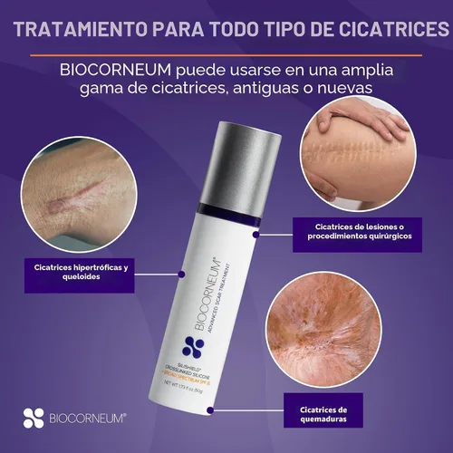 Vista 4 de Supervisión avanzada de cicatrices con FPS 30 bioCorneum (tamaño: 10 g)